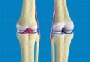 Scientists 3D-Bioprint Regenerative Knee Cartilage Tissue